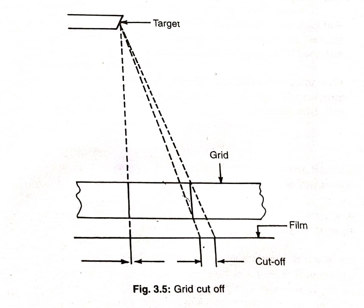 Grid Cutoff In Radiography Radiologystar