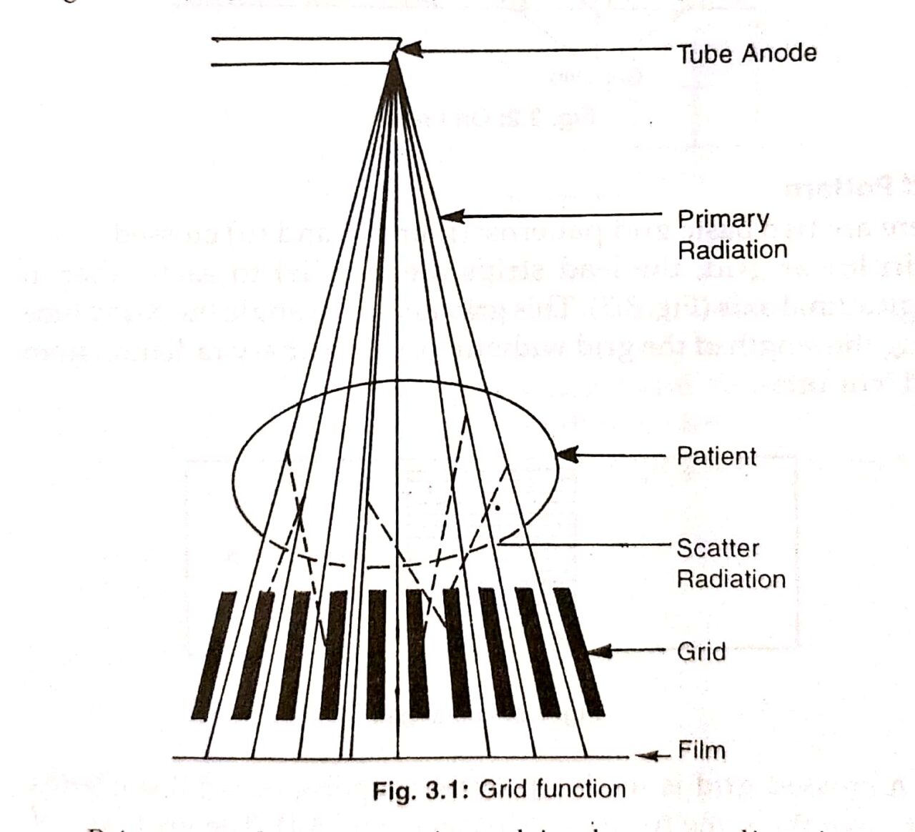 grids-radiologystar