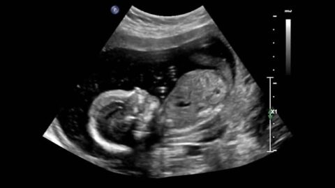 2D Ultrasound. - radiologystar