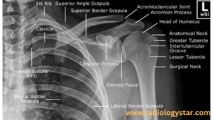 X-ray Anatomy Of Clavicle Bone