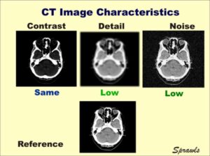 image characteristic in CT scan